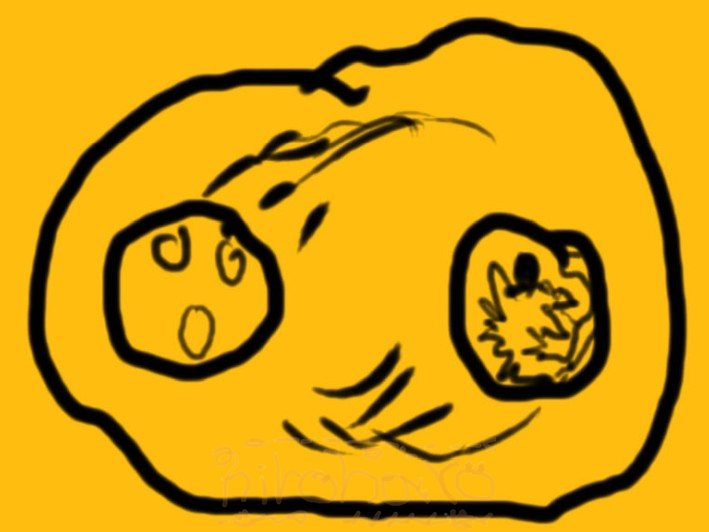 模式図：事故、事件、災害、戦争などで緊張のピーク時。人間の意識は奥に避難し、現実感が薄れる。神経系が前面に出て対処しようとする。